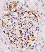 RHBDF2 Antibody in Immunohistochemistry (Paraffin) (IHC (P))