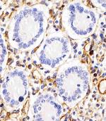 RHBDF2 Antibody in Immunohistochemistry (Paraffin) (IHC (P))