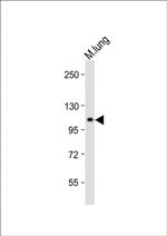 RHBDF2 Antibody in Western Blot (WB)