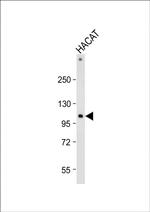 RHBDF2 Antibody in Western Blot (WB)