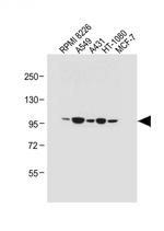 RHBDF2 Antibody in Western Blot (WB)