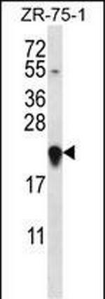 GAGE12H Antibody in Western Blot (WB)