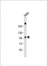 ZCCHC14 Antibody in Western Blot (WB)