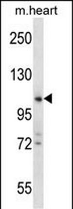 ZCCHC14 Antibody in Western Blot (WB)