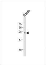 VKORC1L1 Antibody in Western Blot (WB)