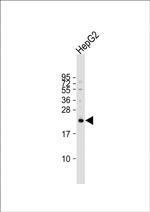 VKORC1L1 Antibody in Western Blot (WB)