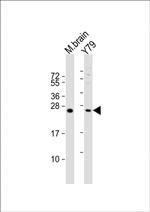 VKORC1L1 Antibody in Western Blot (WB)