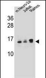 UBE2E2 Antibody in Western Blot (WB)