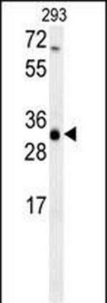 SC4MOL Antibody in Western Blot (WB)