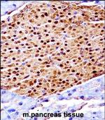 SCYL3 Antibody in Immunohistochemistry (Paraffin) (IHC (P))