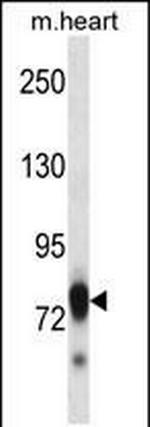 SCYL3 Antibody in Western Blot (WB)