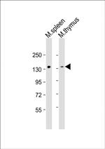 LOK Antibody in Western Blot (WB)