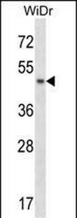 ANKS4B Antibody in Western Blot (WB)