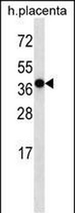 OR5H2 Antibody in Western Blot (WB)