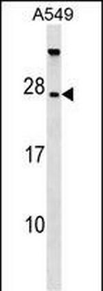 TBC1D28 Antibody in Western Blot (WB)