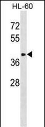 ST8SIA6 Antibody in Western Blot (WB)