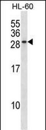 RAB15 Antibody in Western Blot (WB)