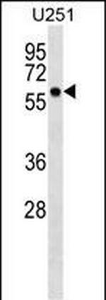 BTN3A3 Antibody in Western Blot (WB)