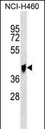 QPCTL Antibody in Western Blot (WB)