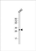 NKX6-2 Antibody in Western Blot (WB)