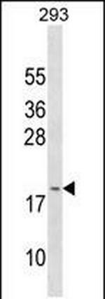 GAGE3 Antibody in Western Blot (WB)