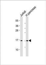 EMP3 Antibody in Western Blot (WB)