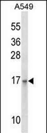 EMP3 Antibody in Western Blot (WB)