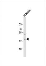 VCX3A Antibody in Western Blot (WB)