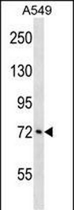 ATXN1L Antibody in Western Blot (WB)