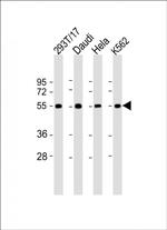 B7-H6 Antibody in Western Blot (WB)