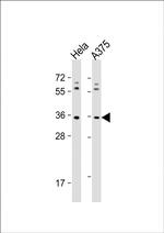 OR5AK2 Antibody in Western Blot (WB)