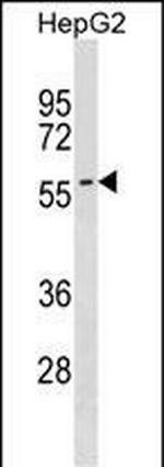 SMPD3 Antibody in Western Blot (WB)