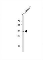 OR8A1 Antibody in Western Blot (WB)