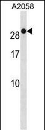 RAB7B Antibody in Western Blot (WB)