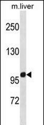 ZNF865 Antibody in Western Blot (WB)