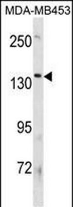 ATP8B3 Antibody in Western Blot (WB)