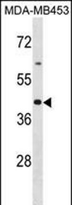 OR2B6 Antibody in Western Blot (WB)