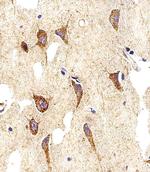 MYH14 Antibody in Immunohistochemistry (Paraffin) (IHC (P))