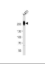 MYH14 Antibody in Western Blot (WB)