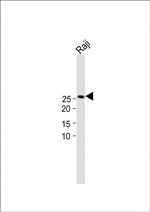 Adenylate Kinase 4 Antibody in Western Blot (WB)