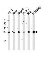 Adenylate Kinase 4 Antibody in Western Blot (WB)