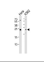 MAD2L2 Antibody in Western Blot (WB)