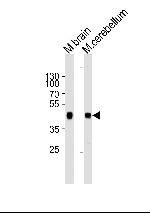 ZDHHC14 Antibody in Western Blot (WB)