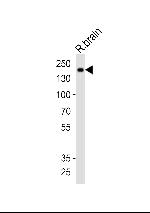 INSRR Antibody in Western Blot (WB)