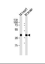 Sbk1 Antibody in Western Blot (WB)