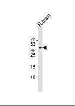 ISL1 Antibody in Western Blot (WB)