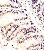 CTR9 Antibody in Immunohistochemistry (Paraffin) (IHC (P))