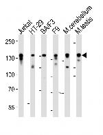 CTR9 Antibody in Western Blot (WB)