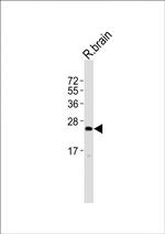 UPK2 Antibody in Western Blot (WB)