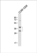 Nkx2.5 Antibody in Western Blot (WB)